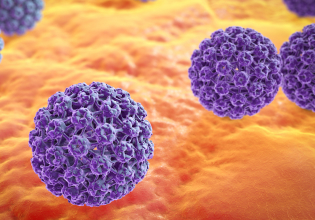 자궁경부암검사